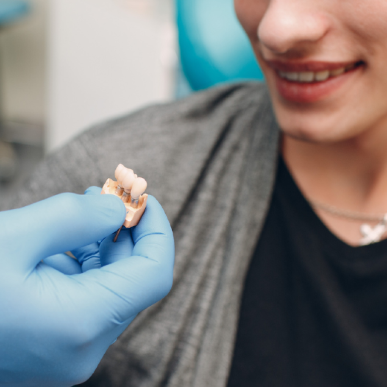 service-implant-dentistry