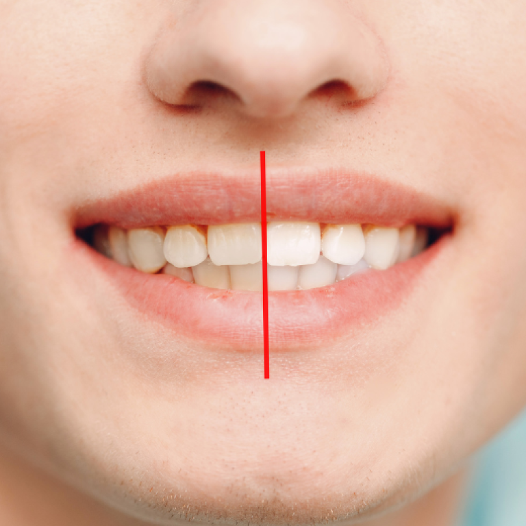service-smile-makeover
